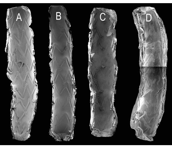 de cada um dos tipos de stents foi suficiente, à exceção do grupo de stents recobertos com polímero na face abluminal, que foi retirado desta análise comparativa.