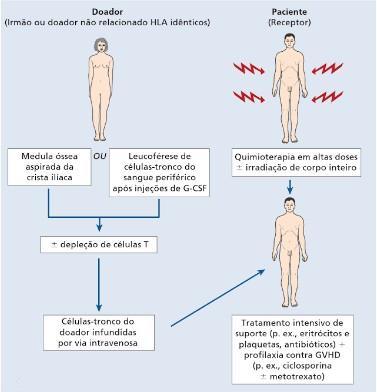 53 é a complicação no TCTH alo responsável por dificultar parcialmente os esforços para expandir a qualidade de vida do paciente transplantado (LAMEGO e cols, 2010). FIGURA 8.