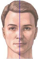 Figura 1 Desenho do T facial, a partir da linha interpupilar e da linha média facial Esta análise contempla três terços sendo que o superior inicia-se na linha do cabelo e estende-se até à glabela,