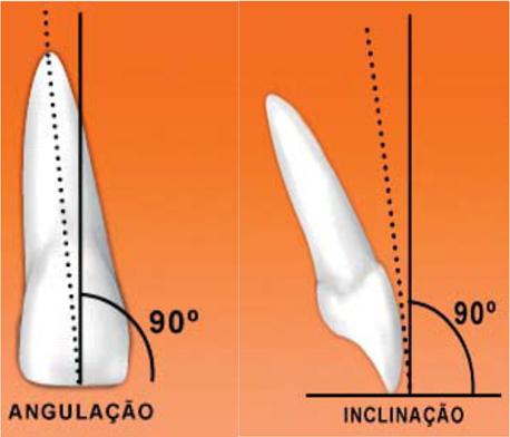 Para que seja visível uma proporcionalidade equilibrada o incisivo central superior deve exibir uma largura de 60-65% em relação à sua altura (Conceição e Masotti, 2007). iv.