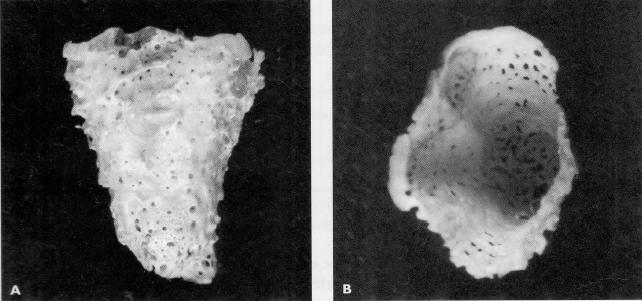 4. Características anatómicas dos dentes naturais Os dentes presentes nas arcadas dentárias exercem funções como a mastigação, proteção e sustentação dos tecidos moles.