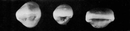 Figura 24- Face oclusal do primeiro molar inferior (Adaptado do Madeira, 2006).