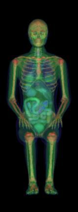 O primeiro banco de dados contém imagens tomográficas da cabeça de um paciente de 18 anos de idade. O segundo banco de dados consiste em imagens tomográficas do torso de um paciente de 36 anos.