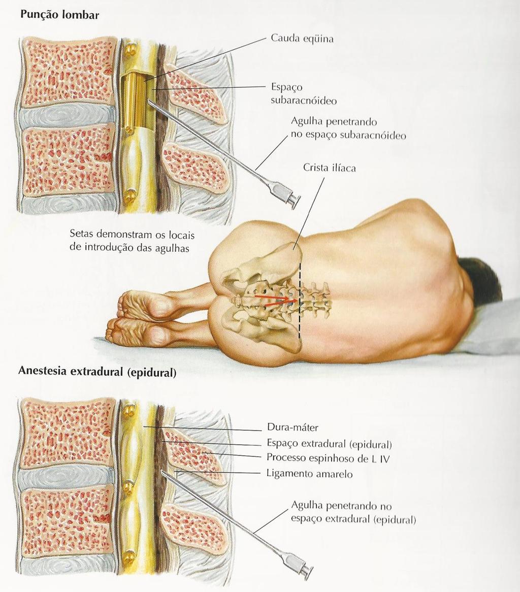 ANESTESIA