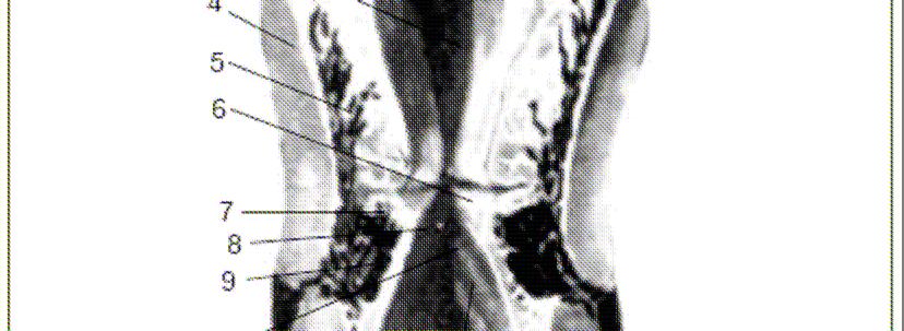 Estruturas anatômicas da laringe. Fonte: Otacílio L.F. e Carlos A. H. de C.