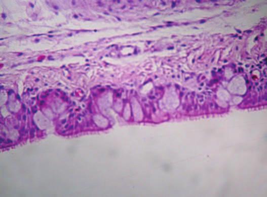 174 Relatório de Projetos Concluídos 2011 A Figura 4. Corte histológico de traqueia de frango, (H&E, 40X).