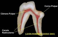 Um dente pode apresentar uma, duas ou três raízes e por isso podem ser uni, bi ou