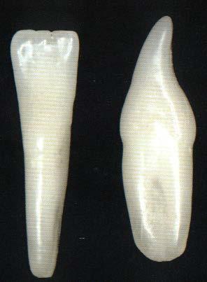 longa e estreita, obliquamente dirigida para baixo do lado mesial.