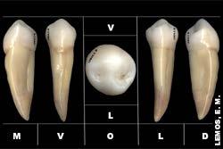 É o menor dente do grupo dos pré-molares, consequentemente, o menor dos pré-molares inferiores, Oclui mesialmente com Canino Superior e distalmente com 1º pré-molar superior.