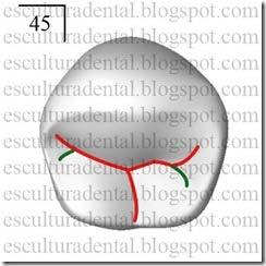 Com 3 cúspides perfeitamente distintas (63% dos casos) Sulco principal e cúspide vestibular com os mesmos caracteres já descritos, Cúspide lingual dividida por sulco secundário, de direção