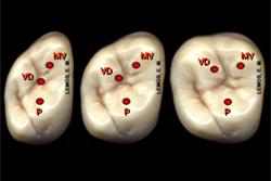 Raízes Em número de três, as raízes mostram a mesma disposição geral que as do 1º molar superior.