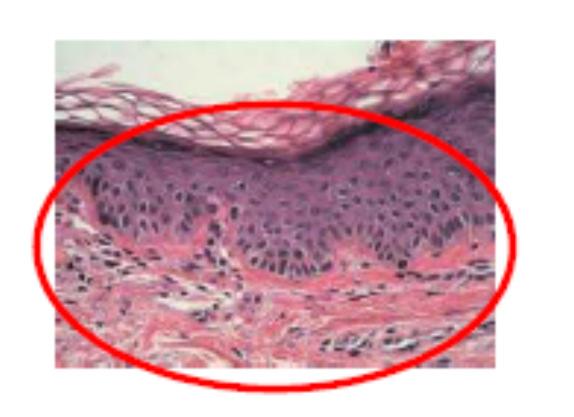 Comprovação de eficácia Estudos in vitro Pré-clínicos A eficácia de VeriSol no metabolismo das células dérmicas foi comprovada em diversos estudos.