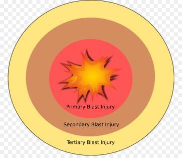 LESÕES PRODUZIDAS POR ARTEFATOS EXPLOSIVOS Explosão = mecanismo