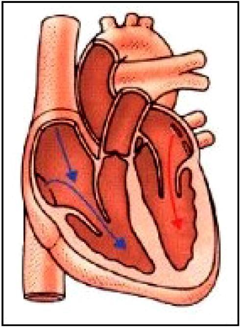 Questão 06 - (IFPE) A hipertensão arterial é um dos problemas que afeta o sistema cardiovascular.