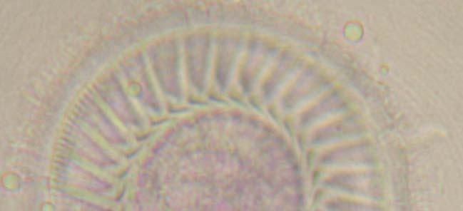 y-1 y y+1 10µm FIGURA 1- Tripartiella sp. encontrada em Pseudoplatystoma coruscans cultivado em Dourados, Mato Grosso do Sul, Brasil. Impregnação com Nitrato de Prata. Obj: 100x.