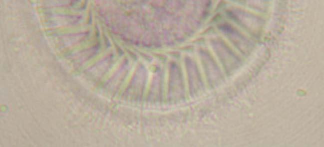 clavodonta Basson & Van As (1987), T. tilapiae Duncan(1977) citado por Bondad-Reantaso & Arthur (1989), T. lechridens, T. leptospina, T. macrosoma e T.