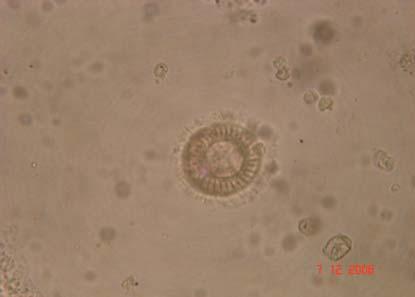 FIGURA 2 - Tripartiella sp. encontrado em brânquias de Pseudoplatystoma coruscans criados em cativeiro em Dourados-MS. Foto tirada em 7/12/2006. Este foi o primeiro relato de Tripartiella em P.