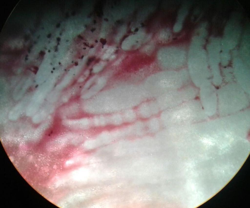 4 Microscopia