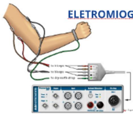 Definição Eletromiografia Estudo da função muscular por meio da análise do sinal elétrico que provém dos músculos