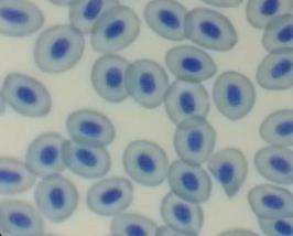 Células sanguíneas de Piaractus brachypomus 3 As lâminas foram coradas com panótico rápido LB, metodologia estabelecida por Romanowsky, na qual a extensão hematológica é submetida à ação de um