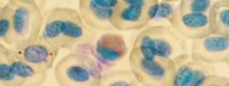 O núcleo mostrou-se irregular com chanfraduras, cromatina frouxa (menos condensada) e coloração púrpura (Figura 4). Essas características são semelhantes à descrição realizada por Ranzani-Paiva et al.