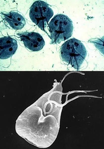 1. Mitocôndrias de tamanho reduzido; formato de pera; alguns podem parasitar o corpo humano. Ex.
