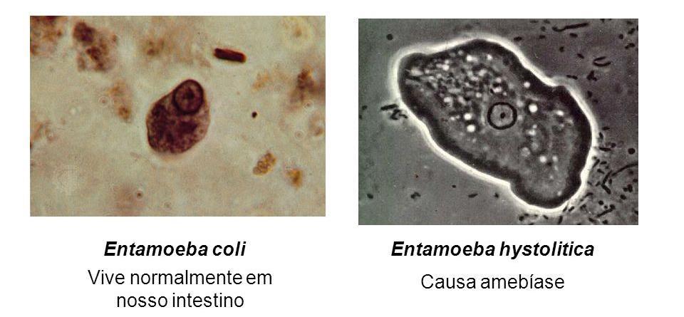 : Entamoeba histolytica Amebíase - Infecção intestinal causada pelo Entamoeba histolytica; - Sintomas: diarreia, cólica intestinal, náuseas e vômitos, sangue nas fezes.