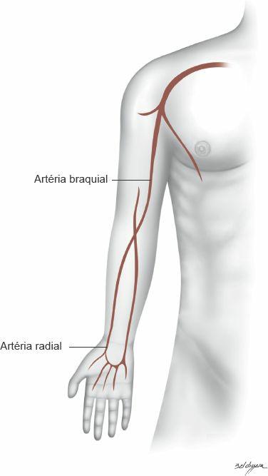 Figura 13.