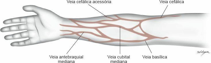 punção venosa), para propiciar a visualização da veia Solicite ao paciente que mantenha o braço imóvel Localize o acesso venoso (Figura 15.