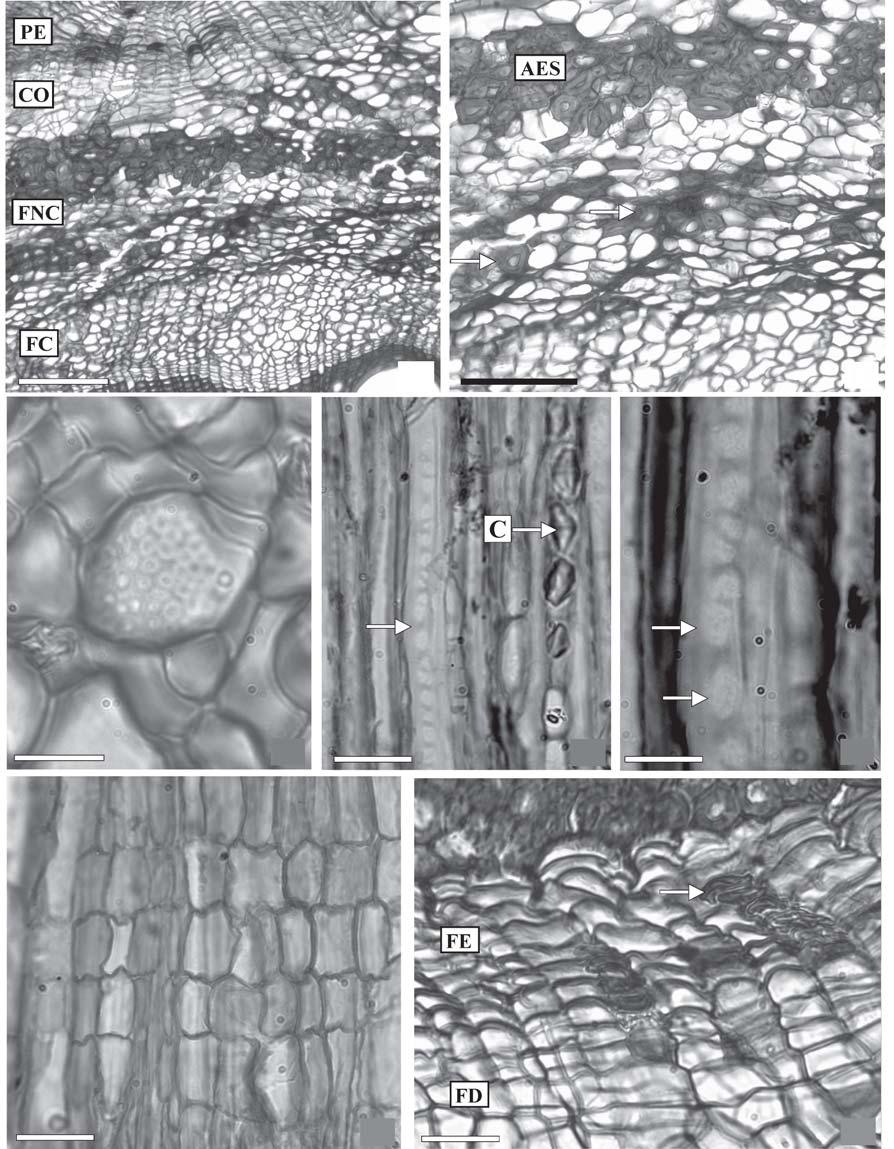 494 Araújo & Costa: Anatomia do caule de Serjania corrugata Radlk. (Sapindaceae) 12 13 14 15 16 17 18 Figura 12.