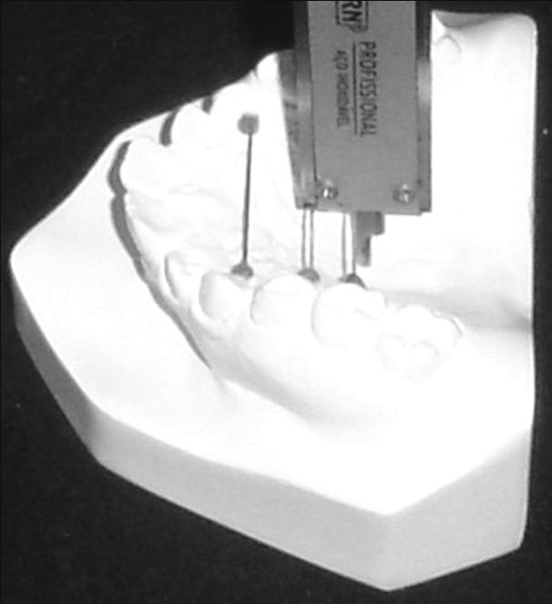 Figura 7 Distância entre os primeiros molares Figura 8 Profundidade ao nível dos primeiros molares Comprimento anteroposterior: medida da distância entre o ponto mais anterior do palato duro até o