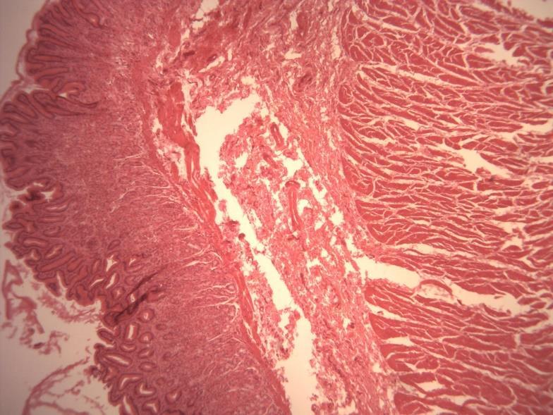 SUBMUCOSA Tecido conjuntivo onde se encontram as glândulas esofágicas. TÚNICA ADVENTÍCIA OU SEROSA É a túnica mais externa do órgão.