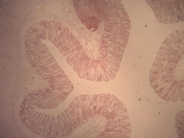 K5 INTESTINO GROSSO HE O intestino grosso apresenta as seguintes túnicas: - Mucosa: com epitélio cilíndrico simples.
