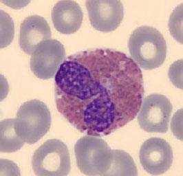 Os eosinófilos e os basófilos possuem processo de diferenciação similar ao dos neutrófilos. Eosinófilos Apresentam coloração laranjada pelos numerodos grânulos secundários.