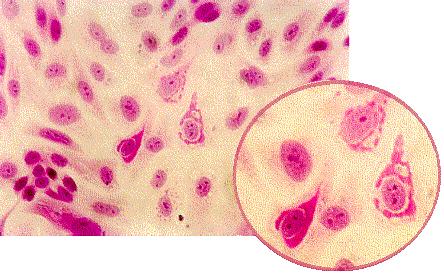 Pox vírus Reovirus