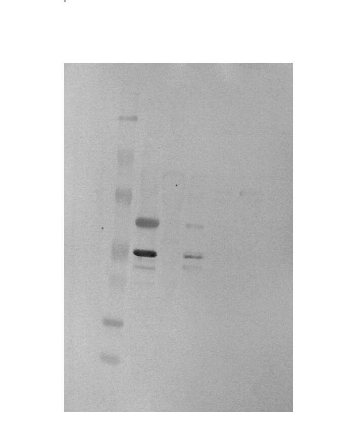 A B δ β 1 β 2 α 1 α 2 0 kda kda 124 0 δ β 1 β 2 α 1 α 2 80 49,1 36 24 14 38,4 28,9,6 7,1 Fig.II-1.13- Detecção das subunidades glicosiladas das δ-vicinina, α-vicinina e β- vicinina.