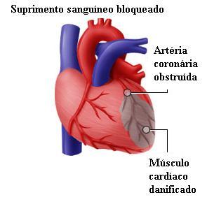 cardíacas