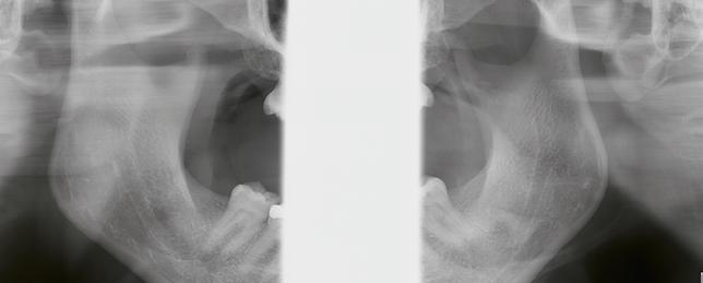 O presente: um diagnóstico completo O futuro: um fluxo de trabalho integrado O software integral para radiografias