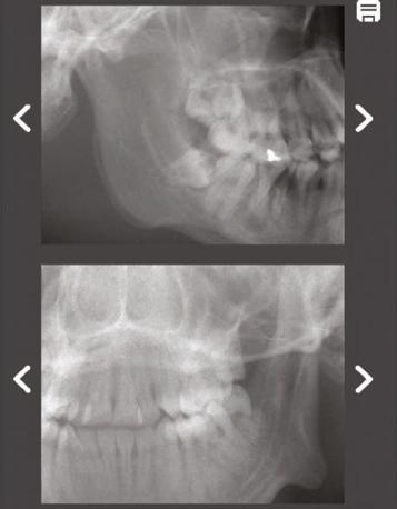 precisão de posicionamento do FOV pode ser verificada ou ajustada, caso necessário, antes do exame CBCT.