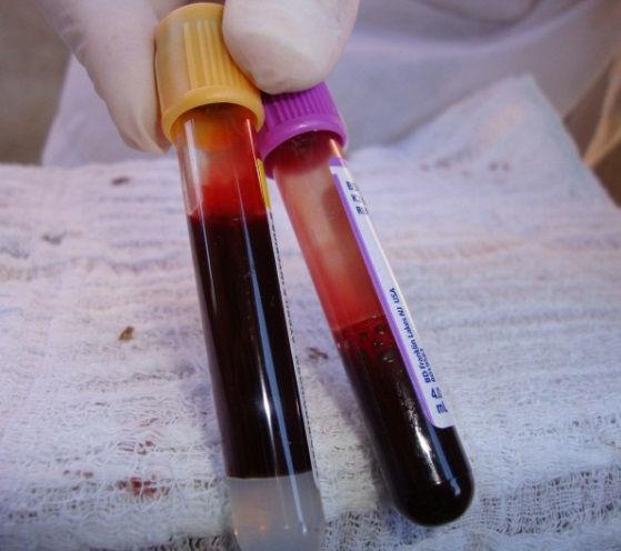 5 Coleta de sangue periférico e preparo de extensões sanguíneas De cada cão foram coletadas pequenas amostras de sangue dos vasos