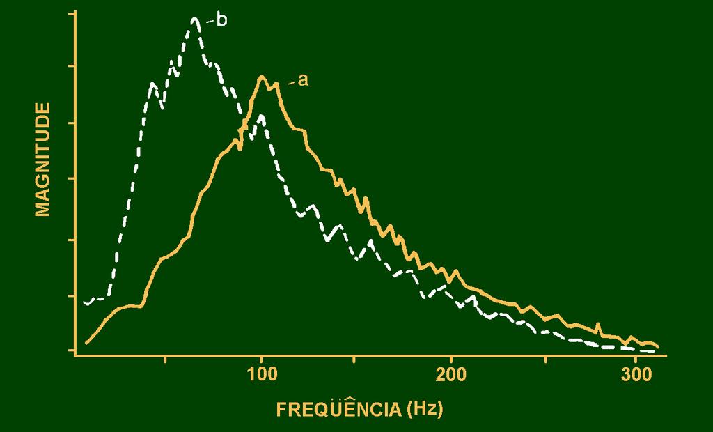 Sinal semg Processado - Espectral Diagrama representativo da mudança da potência espectral do sinal EMG antes (a) e após (b) o