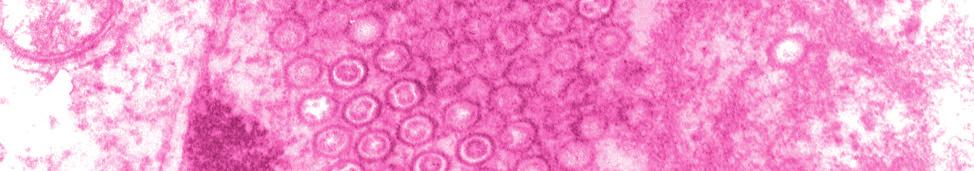 Patogenia das infecções víricas - Interações dos vírus com as células e com os hospedeiros 7 Eduardo Furtado Flores 1 1 Introdução... 189 1.1 Conceitos básicos...190 2 Patologia em nível celular.
