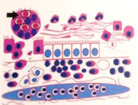 8. Lesões Micro