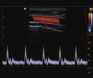 QuickScan Importantes parâmetros de imagem podem ser automaticamente otimizados ao toque de um botão, maximizando a eficiência no fluxo de trabalho.