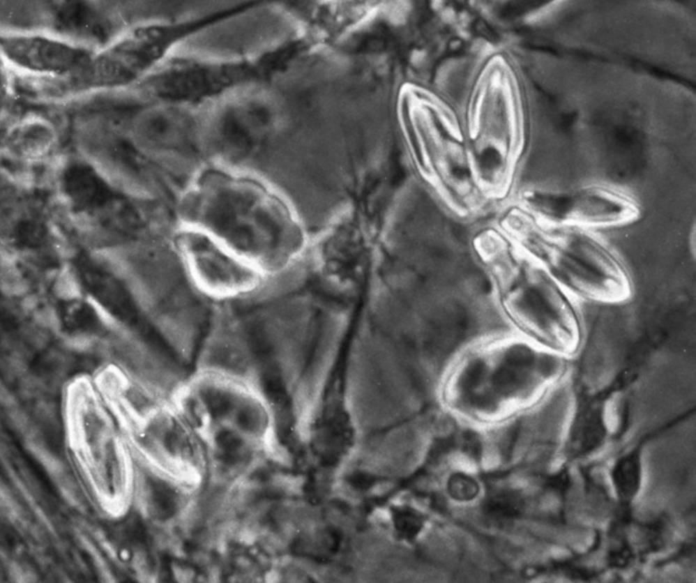 Carbonato de cálcio Sílica Microscleras