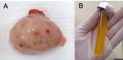 17 Figura 2: Aspiração folicular in vitro. A) Ovário bovino a ser aspirado. B) Pellet contendo CCOs. Fonte: arquivo pessoal. 2.1.1.2 Procura e Seleção dos oócitos Após decorrido o tempo de