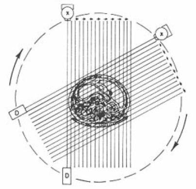 Quatro gerações Primeira geração: one source, one detector Pencil beam ( 1 mm) 1 2 3 1. Translação 2.