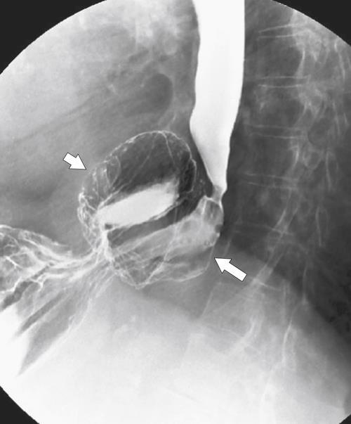 TRATO GASTRINTESTINAL: