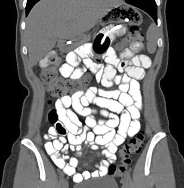 TRATO GASTRINTESTINAL: (ENTEROTC,