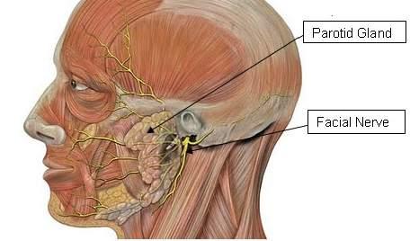 2. PAROTIDECTOMIAS Corresponde a ressecção cirúrgica da glândula parótida, que é uma glândula salivar, localizada sobre o músculo masseter, responsável pelo contorno da porção posterior do ramo